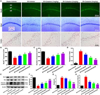 Corrigendum: Neuroprotective Effects of Celastrol on Transient Global Cerebral Ischemia Rats via Regulating HMGB1/NF-κB Signaling Pathway